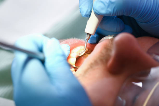 Best Emergency TMJ Treatment in Fennville, MI
