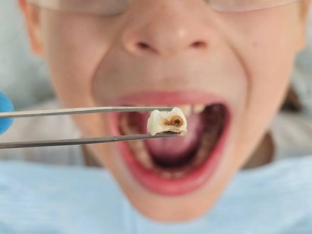 Best Same-Day Emergency Dental Services in Fennville, MI